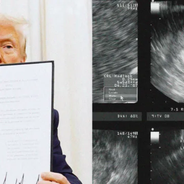 When is a person’s sex determined? Trump has no conception, experts say.