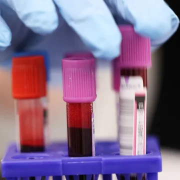 New York Blood Center cancels drives during shortage after cyberattack