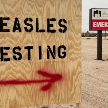 A person dies of measles in West Texas outbreak