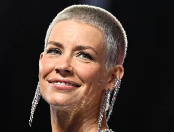 Evangeline Lilly says she was diagnosed with brain damage months after taking fall at the beach