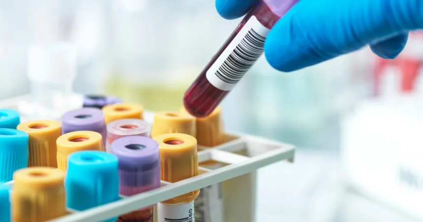 This blood test may predict heart disease better than LDL cholesterol, some doctors say