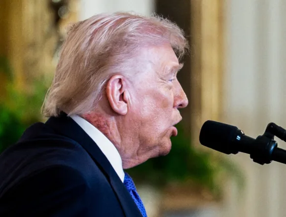 260302-Donald-Trump-rash-ew-223p-c9d507.jpg White House addresses ‘redness’ on the side of Trump’s neck