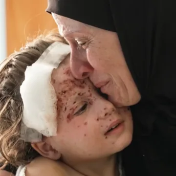 For a surgeon treating Lebanon’s wounded children, their horrific injuries bring back memories from Gaza
