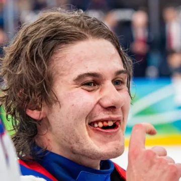 U.S. Olympic hockey hero Jack Hughes finally fixes teeth broken in gold-medal game