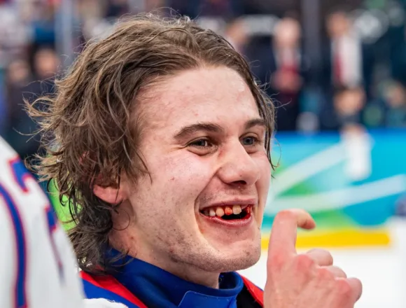 260326-jack-hughes-834-GWR-16fdb4.jpg U.S. Olympic hockey hero Jack Hughes finally fixes teeth broken in gold-medal game