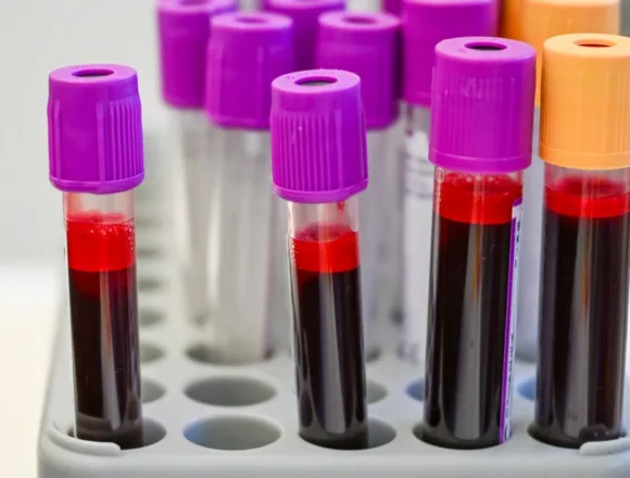 Are cancer-screening blood tests close to prime time?